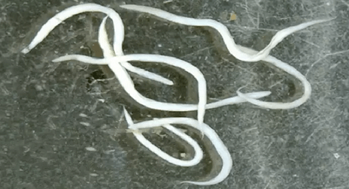 Pinworms στο ανθρώπινο σώμα