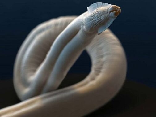 Toxocara από το ανθρώπινο σώμα