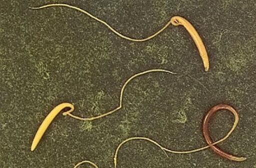 Whipworm από το ανθρώπινο σώμα