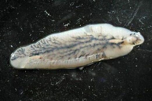 Ηπατική σύγκρουση στον άνθρωπο