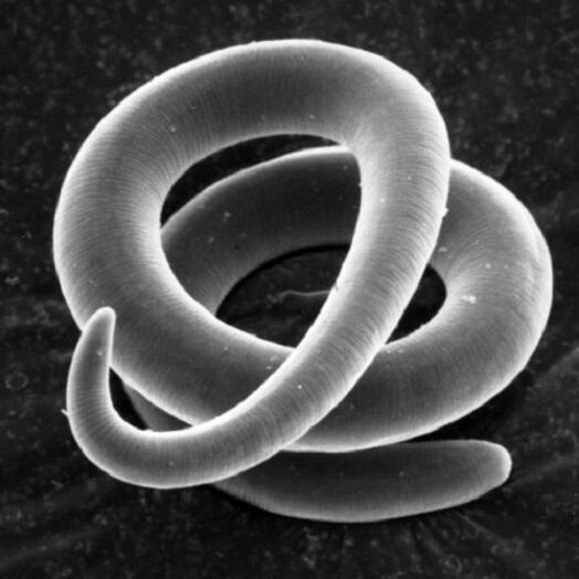 Το παράσιτο σκουληκιών Trichinella στον άνθρωπο