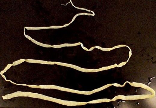 φαρδιά ταινία από το ανθρώπινο σώμα