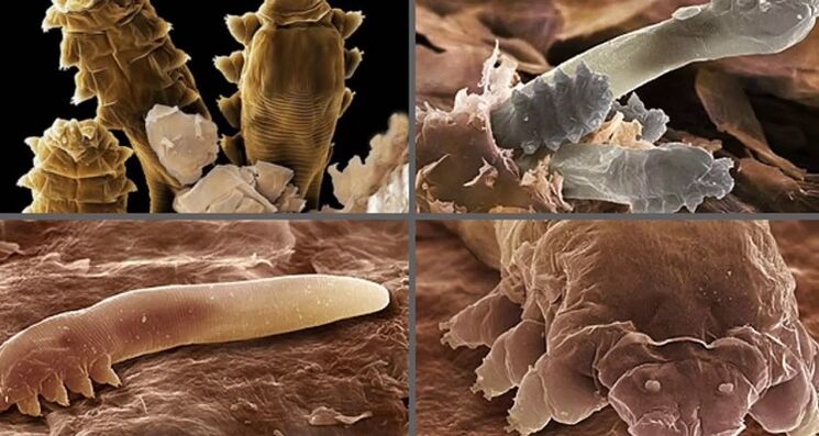 Τύποι παρασίτων του ανθρώπινου δέρματος