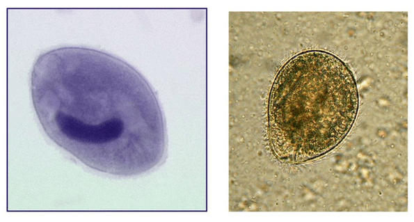 Balantidia ciliates, παράσιτο στο παχύ έντερο